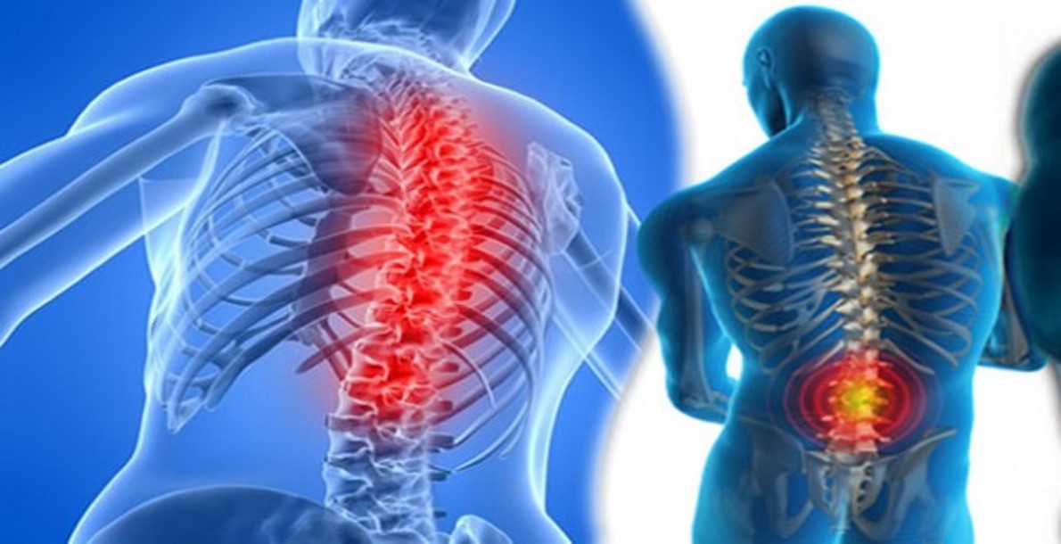 Me Crujen Los Huesos De La Espalda Me crujen las articulaciones. ¿Es sĆntoma de una posible lesión