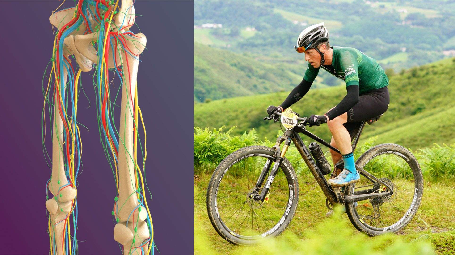 Endofibrosis, una lesión también de ciclistas Endofibrosis, una lesión también de ciclistas