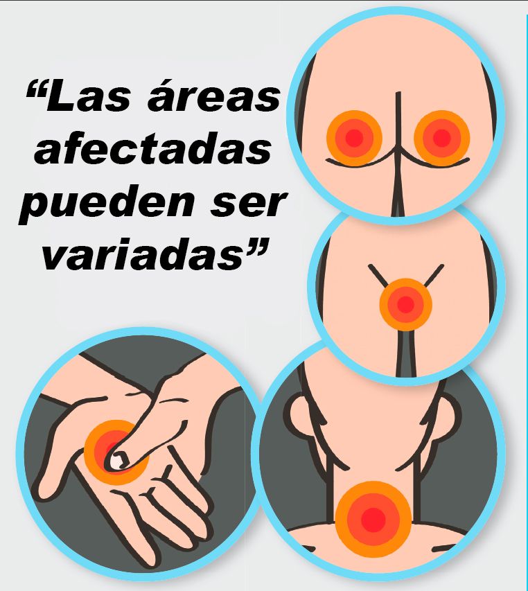 Las quejas más comunes
