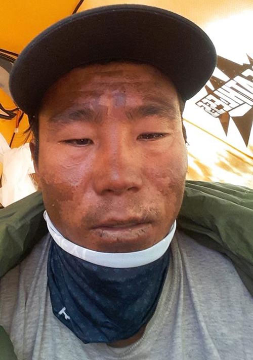 El lado amargo del rescate de Wui Kin Chin El lado amargo del rescate de Wui Kin Chin
