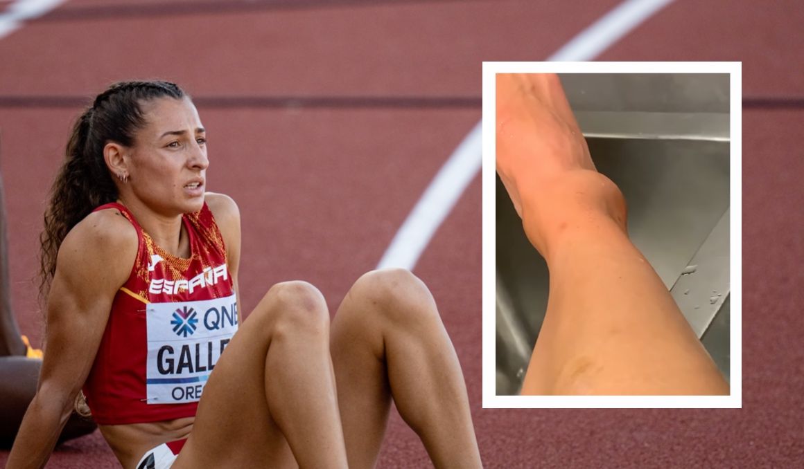 Una imagen de Sara Gallego y, a la derecha, de su tobillo actualmente. SPORTMEDIA. Una imagen de Sara Gallego y, a la derecha, de su tobillo actualmente. SPORTMEDIA.