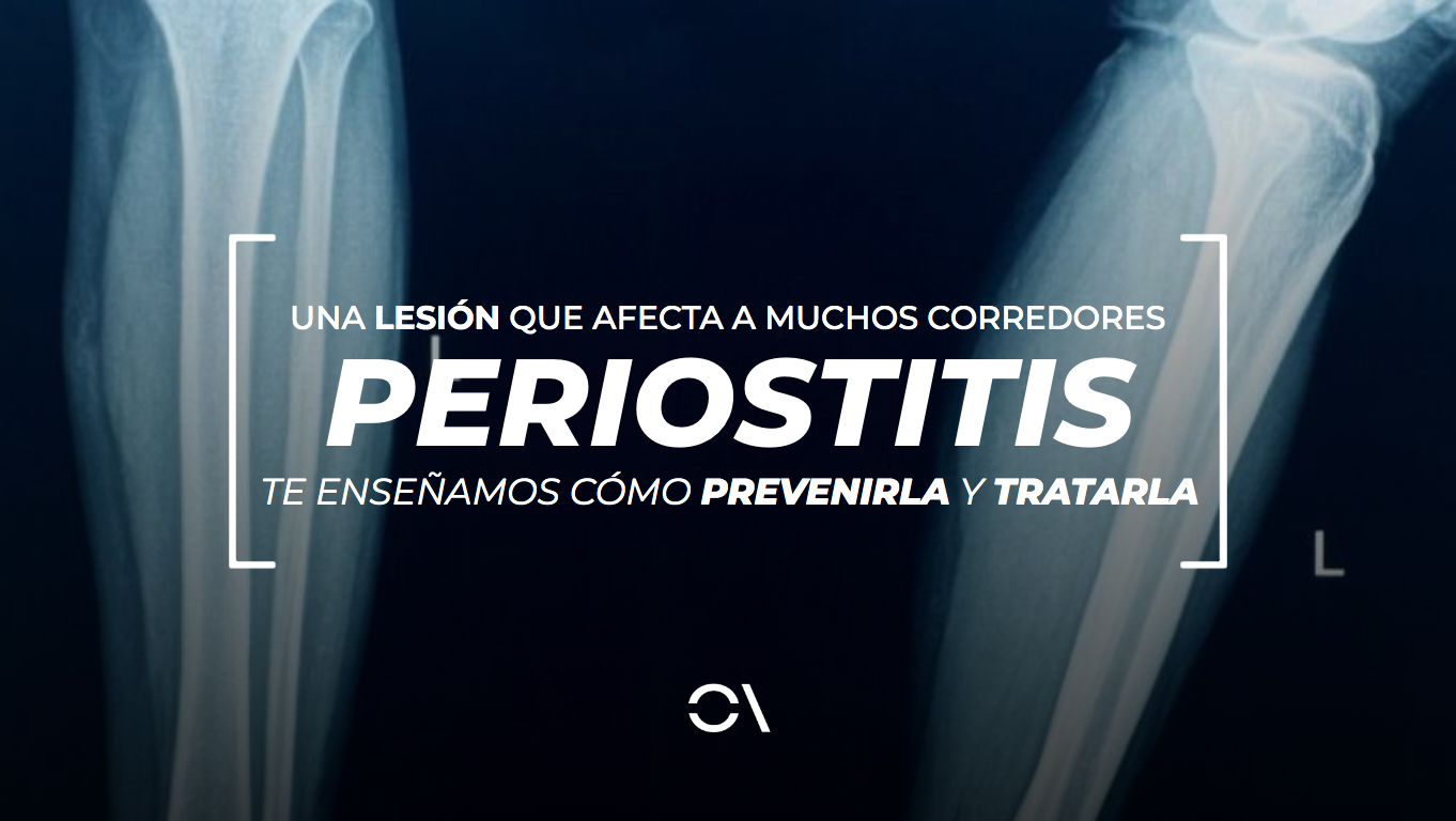 La periostitis tibial es una dolencia habitual entre corredores.