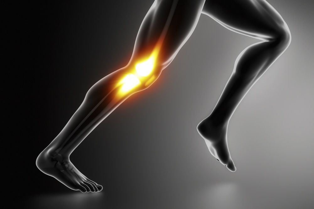 ¿Qué es el síndrome de la cintilla iliotibial?