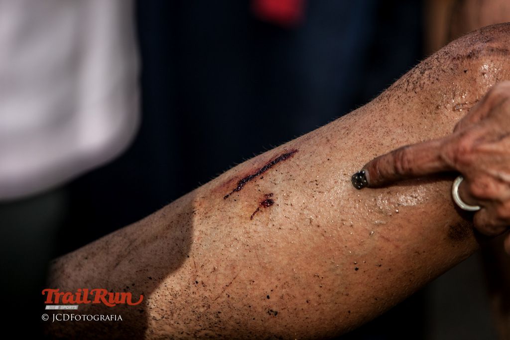 Mundial de Trail Peneda-Geres 2016