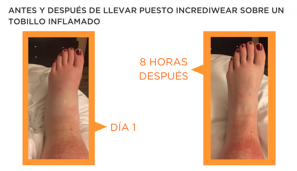 Inflamación de Tobillo 3