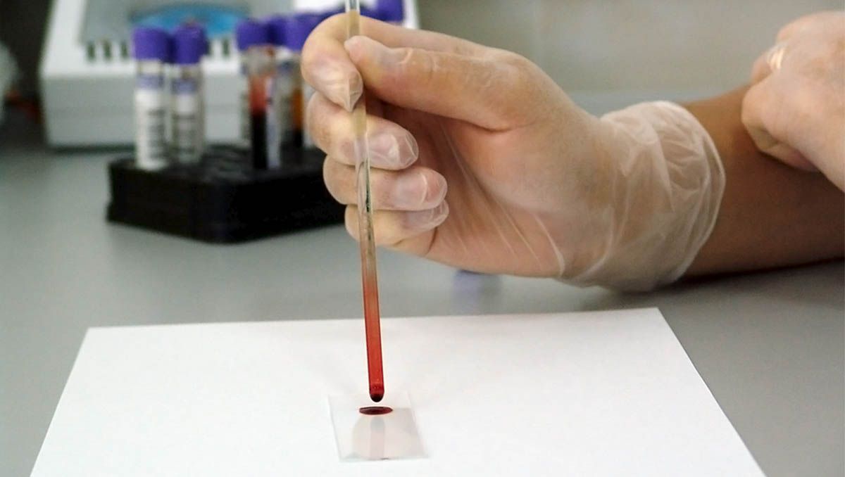 Cómo interpretar una analitica