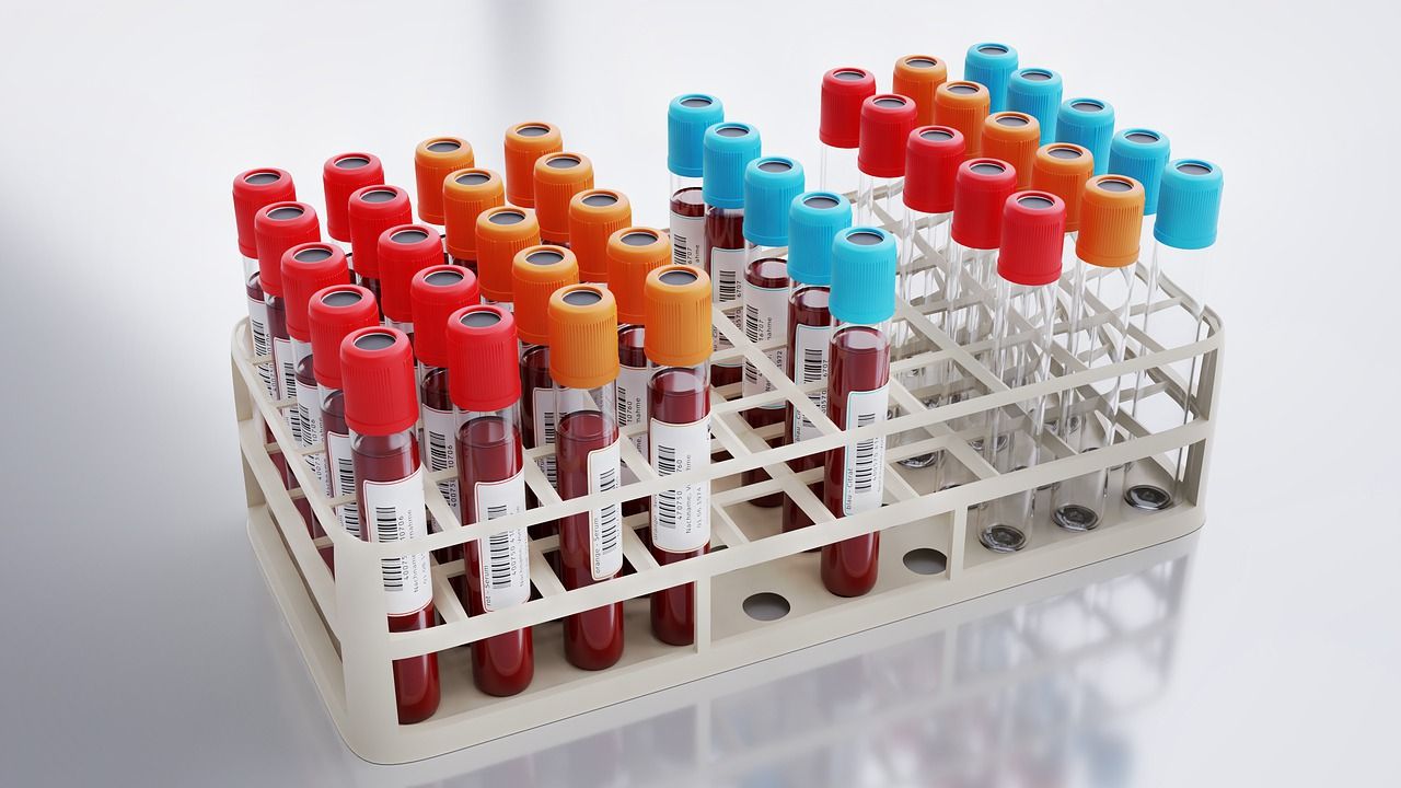 blood collection g9e497258c 1280