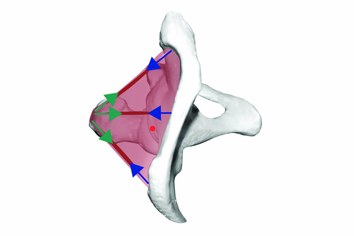 gluteo medio