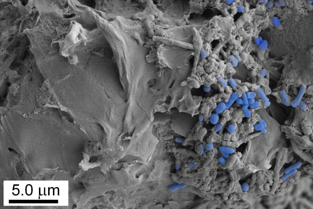 Imagen microscópica de microplásticos colonizados por la microbiota intestinal. Foto CSIC. Imagen microscópica de microplásticos colonizados por la microbiota intestinal. Foto CSIC.