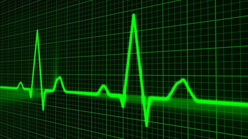 pulse trace 163708 960 720 pulse trace 163708 960 720