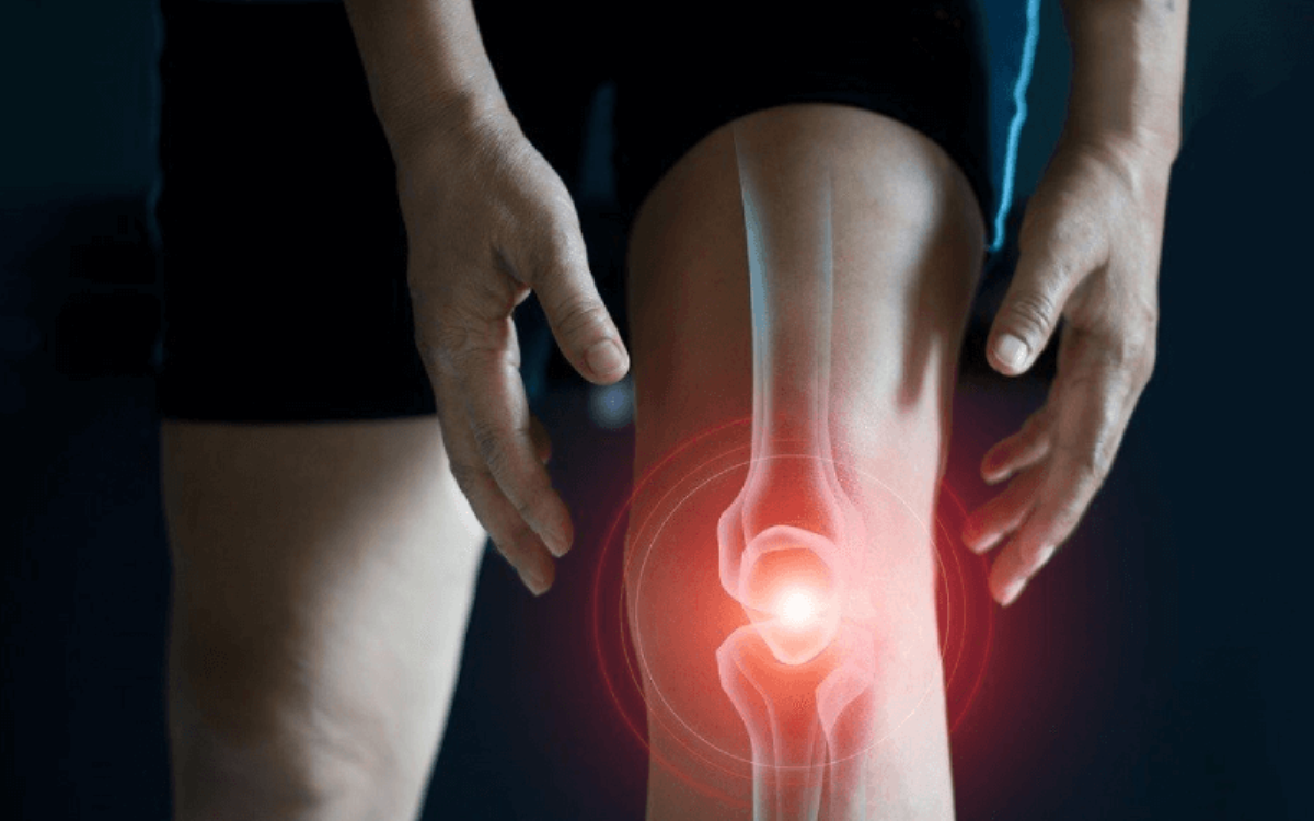 ¿Puede seguir haciendo deporte si sufro de artrosis?