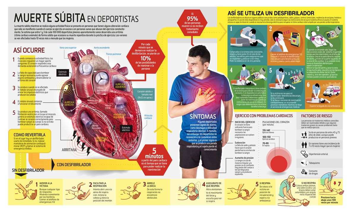 Muerte subita deportistas 2