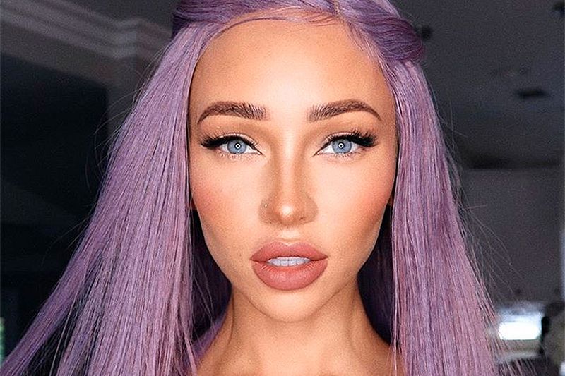 Esta intervención quirúrgica está de moda entre famosos e influencers Esta intervención quirúrgica está de moda entre famosos e influencers