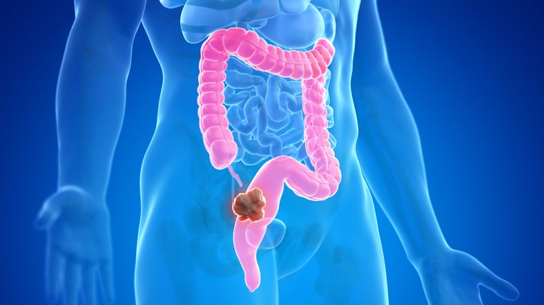 colon mas colon mas