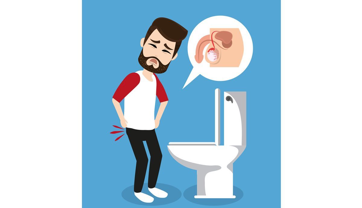 Consejos para el cuidado del suelo pélvico masculino Consejos para el cuidado del suelo pélvico masculino