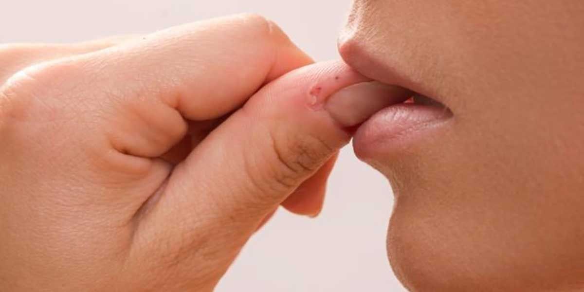 Perfeccionismo y morderse la uñas
