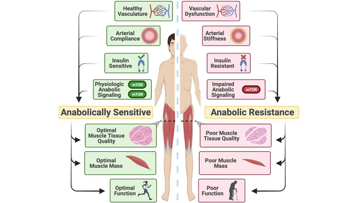 Sarcopenia y sus efectos sobre la salud Sarcopenia y sus efectos sobre la salud