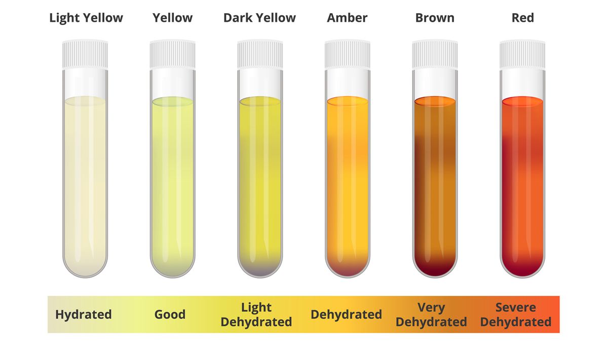 ¿Qué significa el color de la orina?
