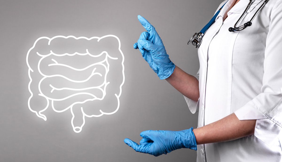Síntomas y causas del síndrome del intestino irritable