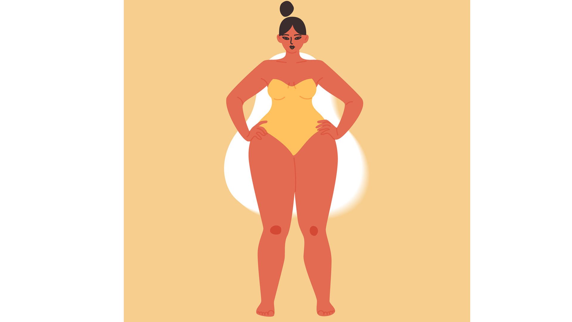 ¿Qué es el lipedema?