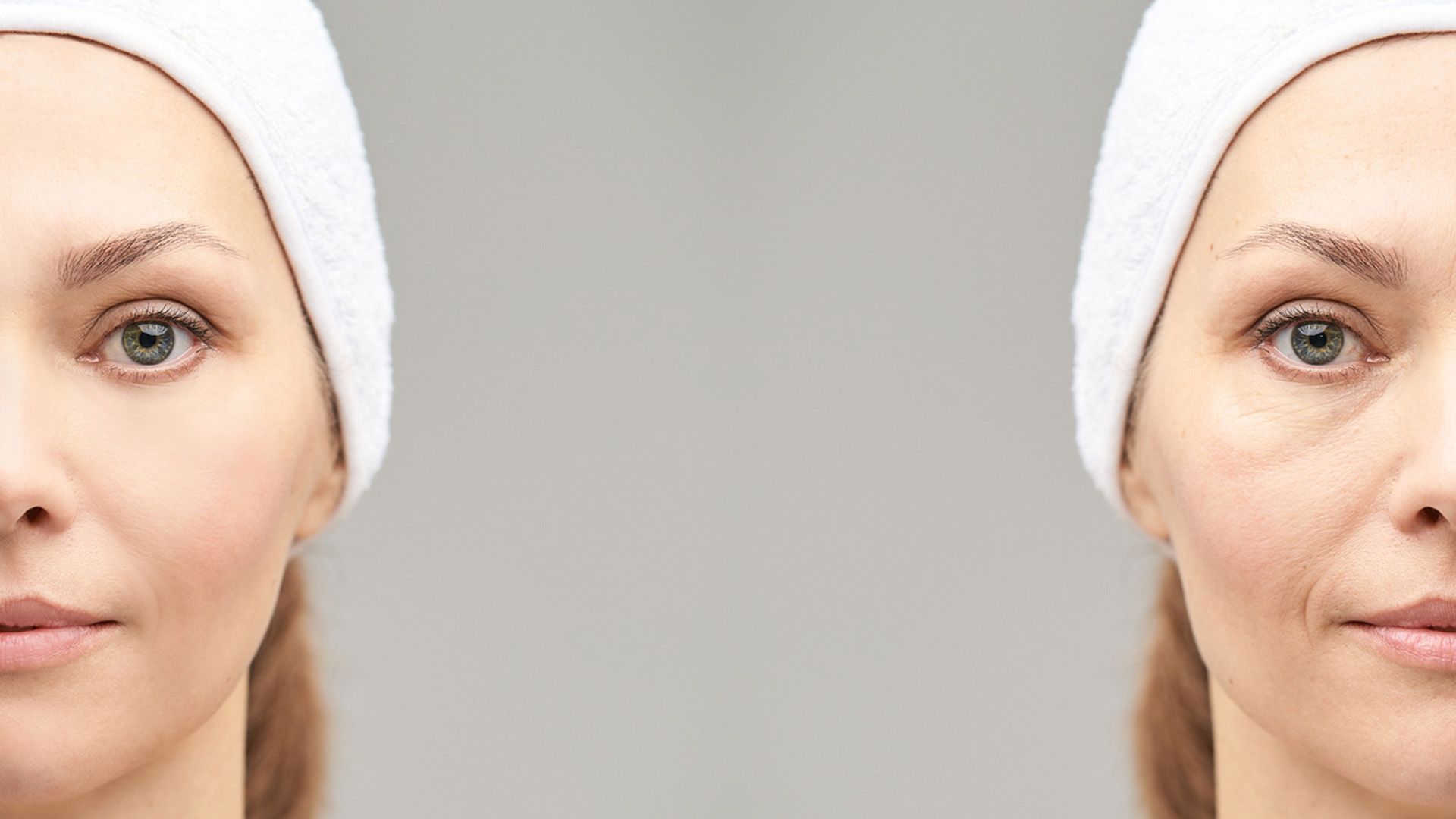 Qué es la cara de cortisol. El estrés también se nota en la cara