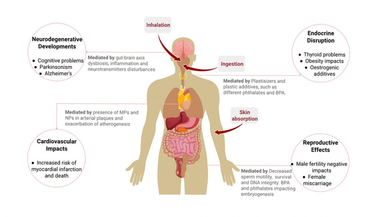 Efectos negativos en la salud humana de los microplasticos MPs y nanoplasticos NPs Efectos negativos en la salud humana de los microplasticos MPs y nanoplasticos NPs
