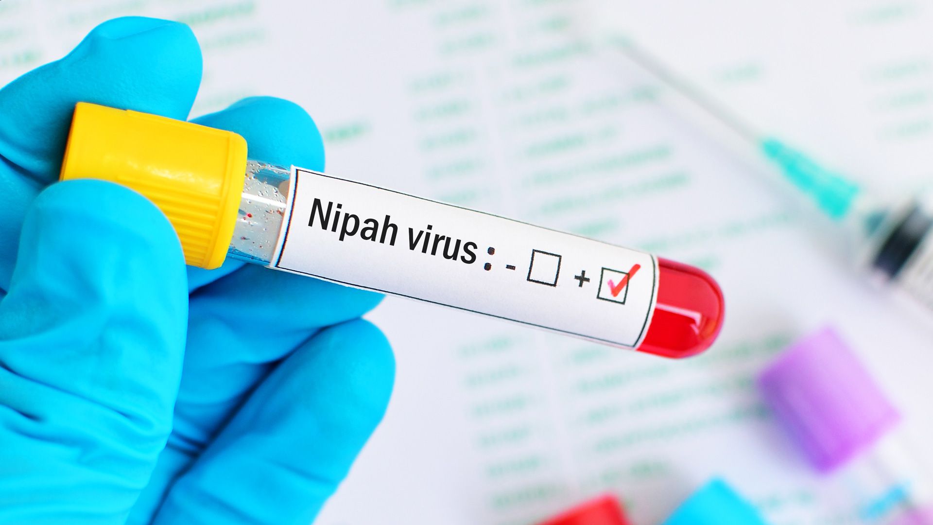 El virus Nipah. Lo que debes saber si eres deportista, sin alarmismos (Foto: iStock)