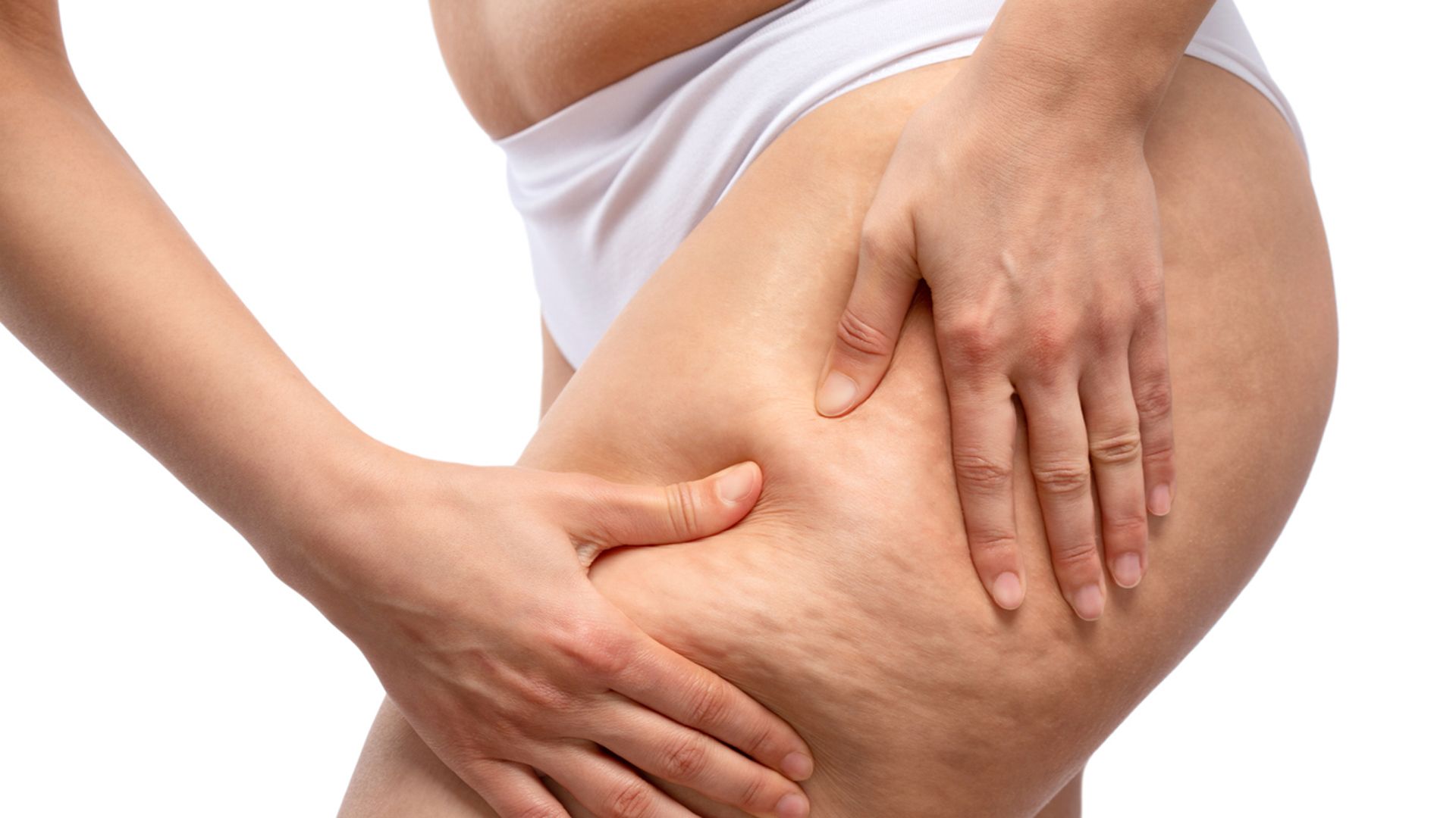 La grasa de los muslos también es un marcador de riesgo cardiovascular
