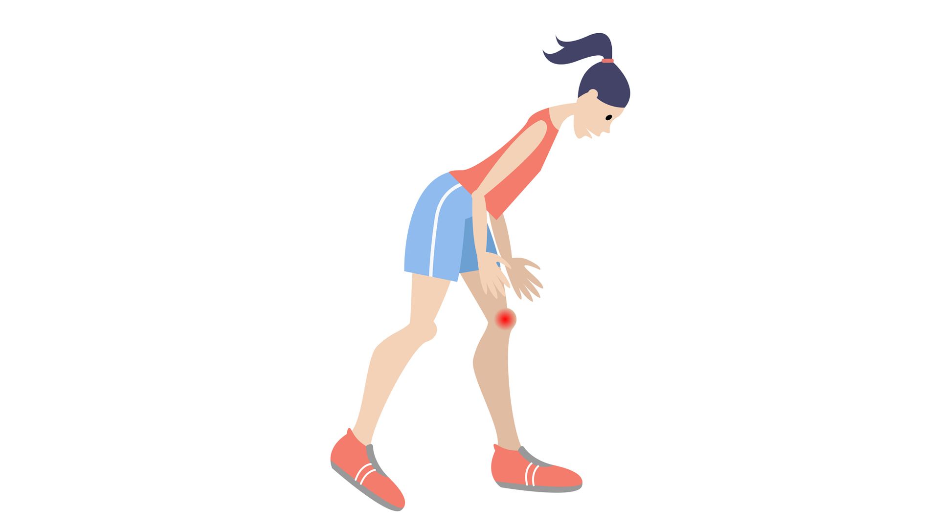 Un pequeño ajuste al caminar podría retrasar la cirugía de rodilla por años