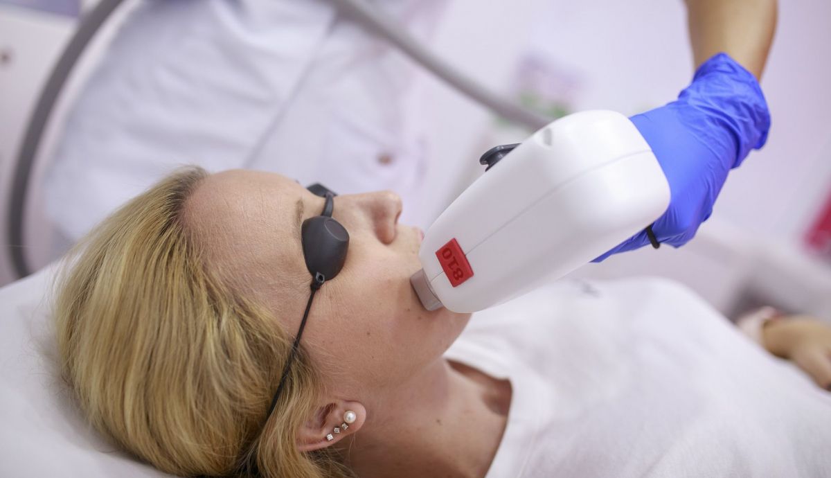 SinVello! Depilación Laser en Black Friday 2025