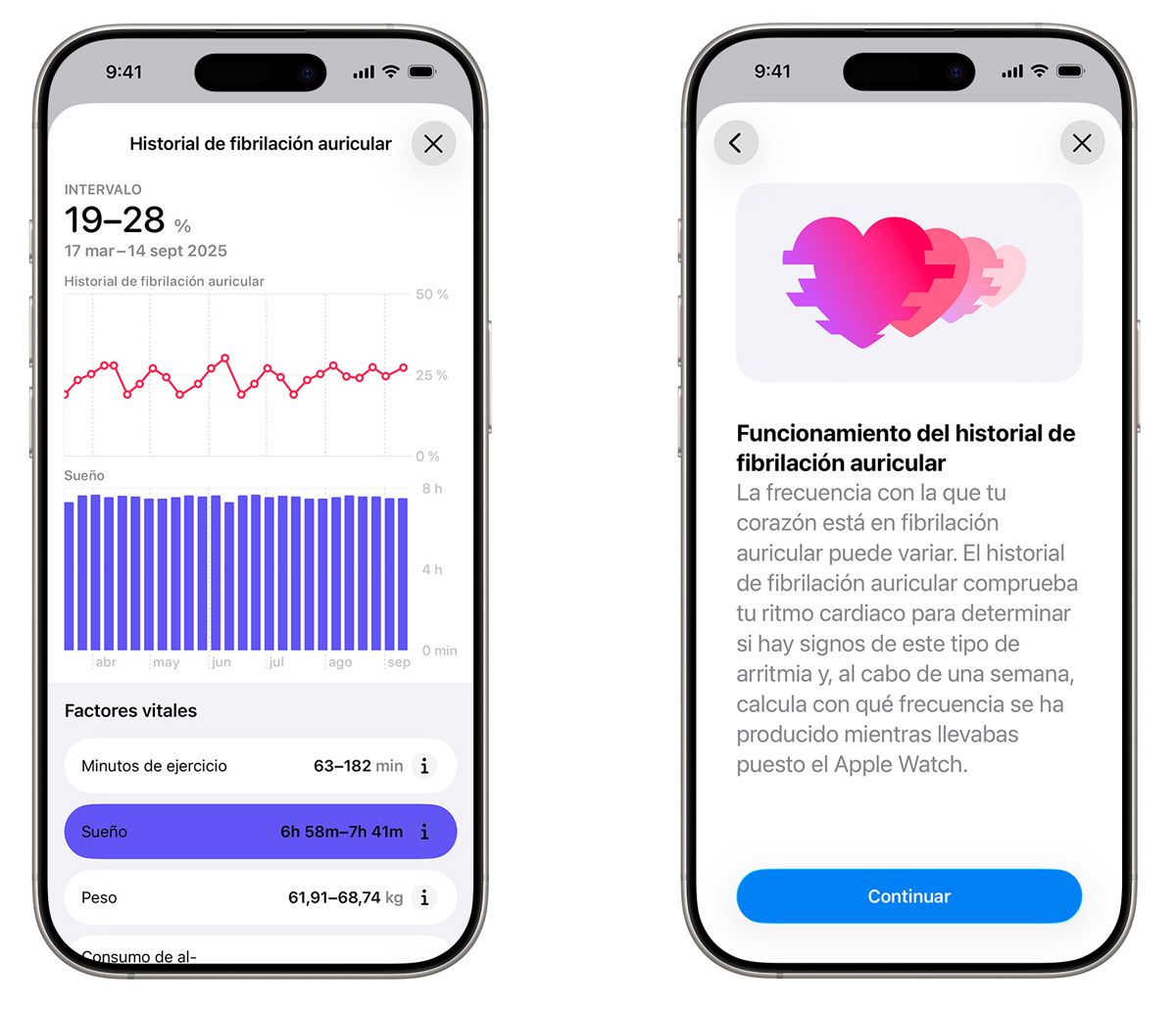 Historial de fibrilación articular