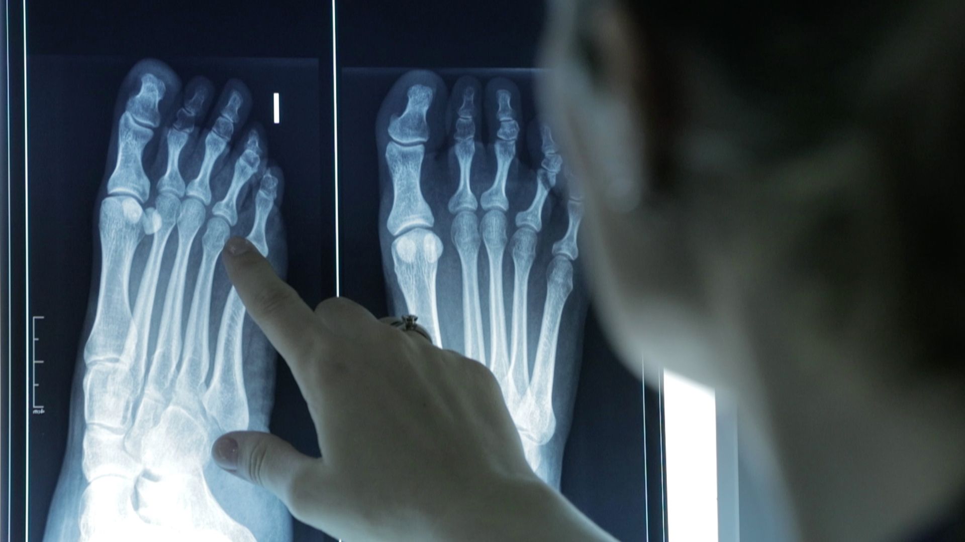 El sedentarismo también daña a los pies