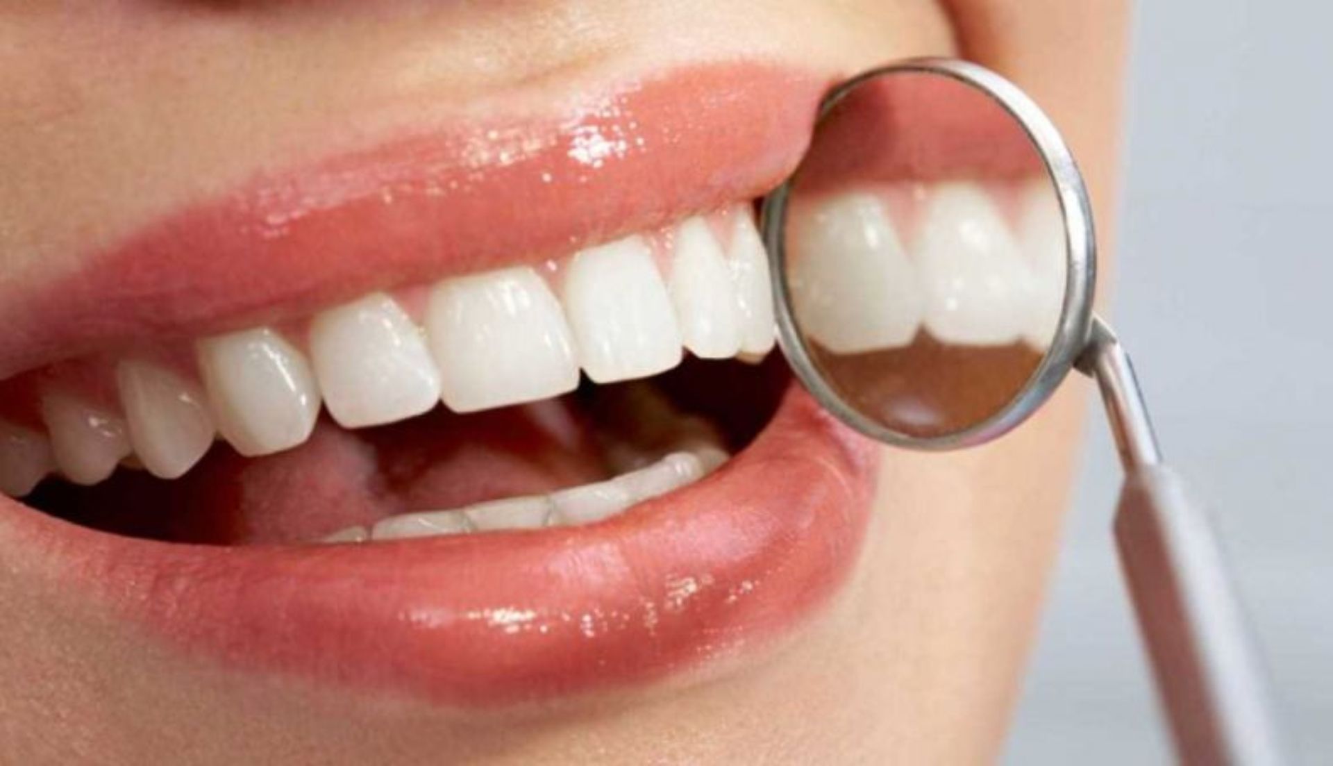 5d5a53960ce69442388b4583 salud dental problemas 2 790x454 5d5a53960ce69442388b4583 salud dental problemas 2 790x454