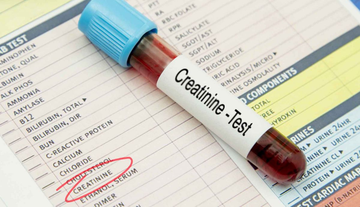 Creatinina alta: ¿riñones o más músculo?