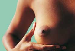 Imagen de Galeria de Aprende a prevenir el cáncer de mama