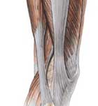 Imagen de Galeria de Programa para epicondilitis o tendinitis con Sales de Schüssler