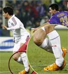 Imagen de Galeria de Consejos para tratar un esguince de tobillo