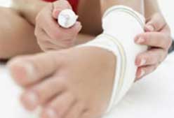 Imagen de Galeria de Consejos para tratar un esguince de tobillo