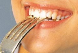 Imagen de Galeria de Adelgazar y deporte