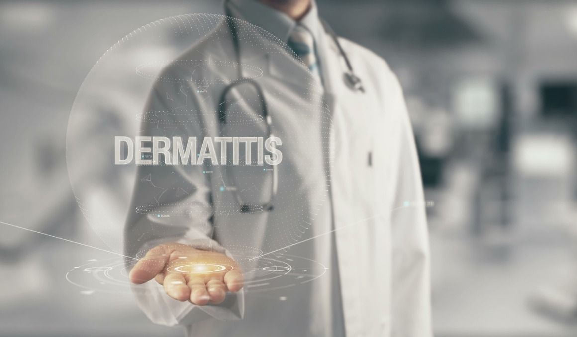La dermatitis atópica es crónica.