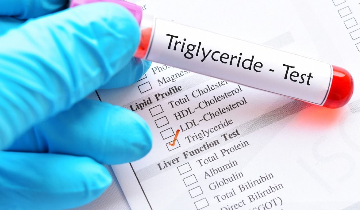 Es importante medir nuestro nivel de triglicéridos para evitar problemas de salud.