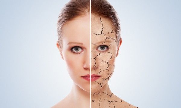 Las cinco claves para cuidar la piel en invierno