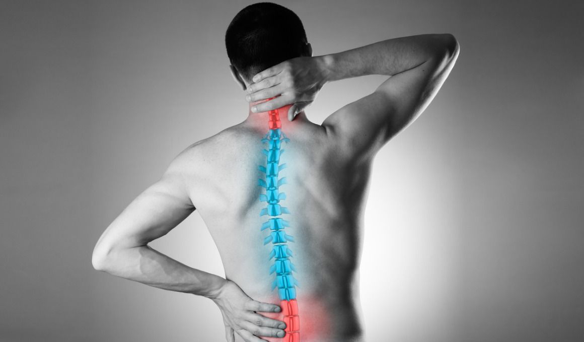 La escoliosis es una curvatura de la columna vertebral.