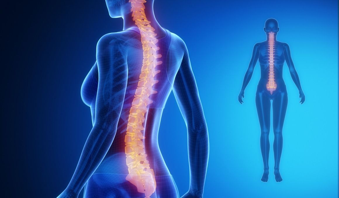La lordosis se puede diagnosticar mediante una radiografía.