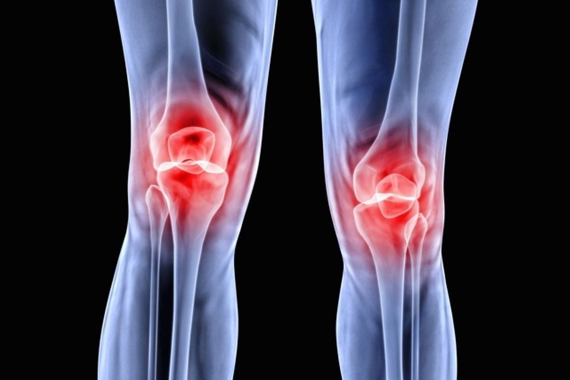 ¿Puedo seguir corriendo con condromalacia?