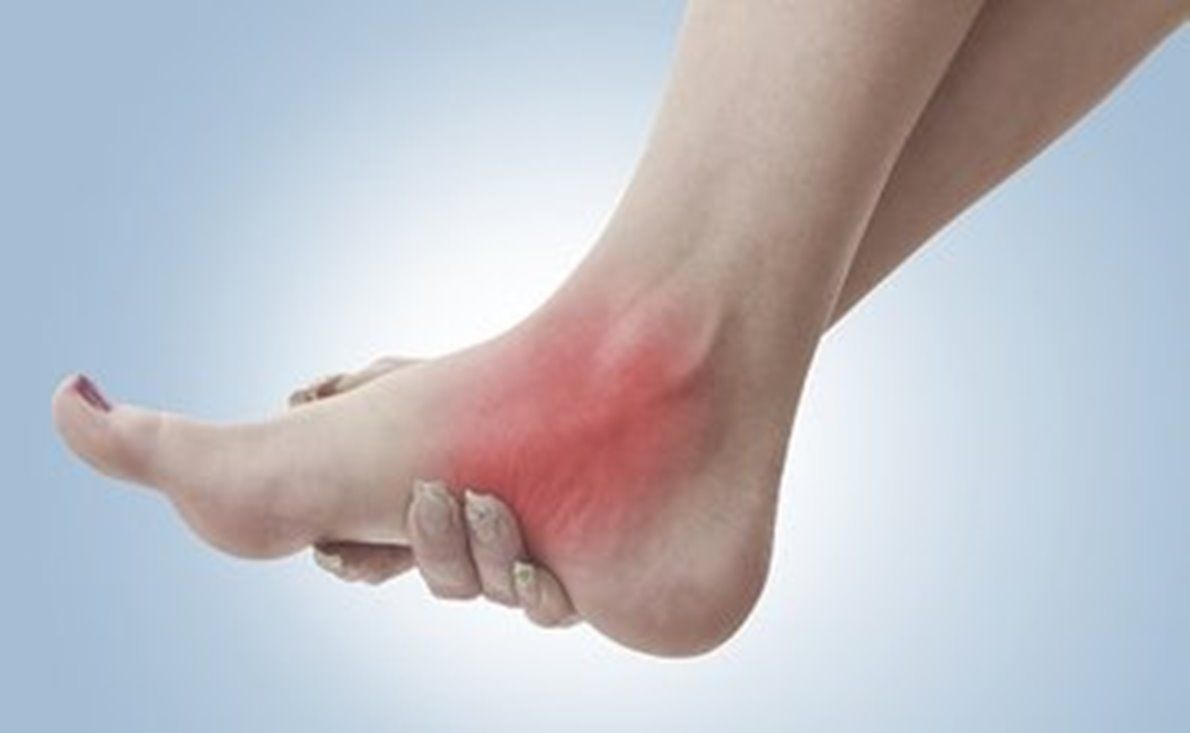 Soluciones para la tendinitis del tibial 