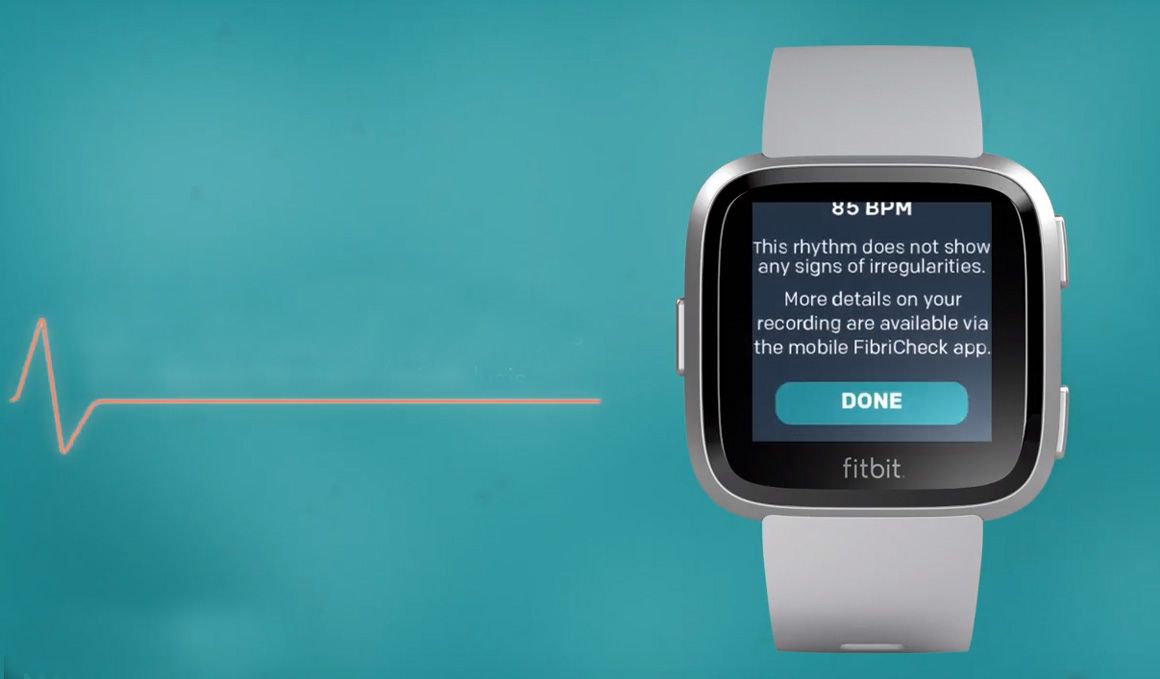 El Fitbit que previene un ataque al corazón