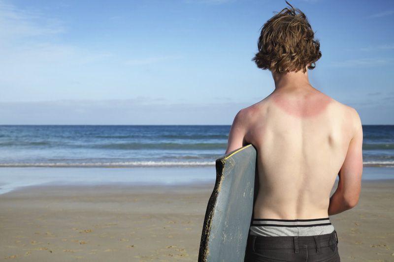 Remedios naturales contra los males del verano