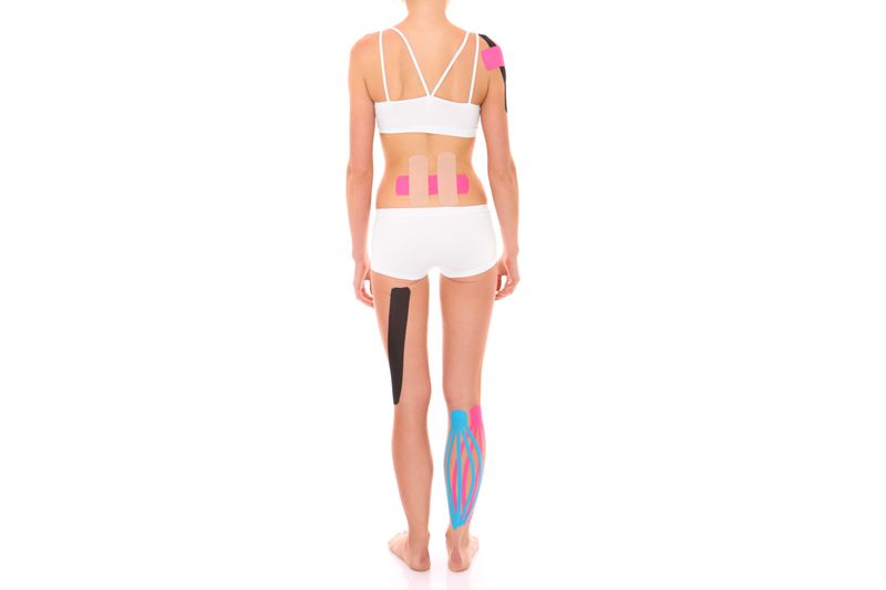¿Funciona el kinesiotape?