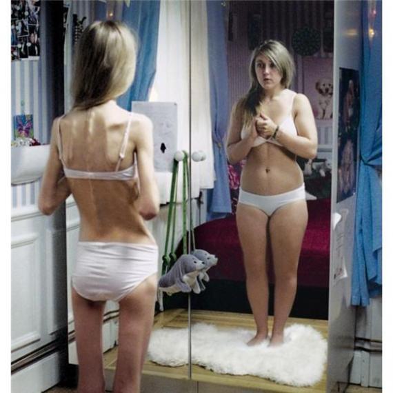 Salir de la anorexia y bulimia, sí, se puede. Salir de la anorexia y bulimia, sí, se puede.